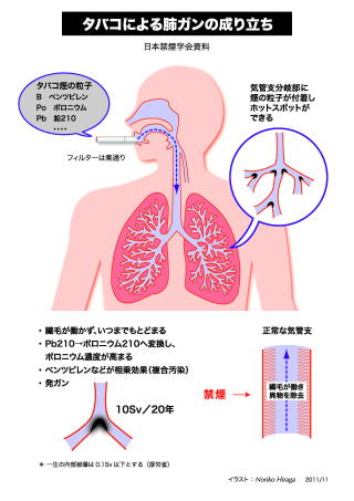 タバコによる肺ガンの成り立ち